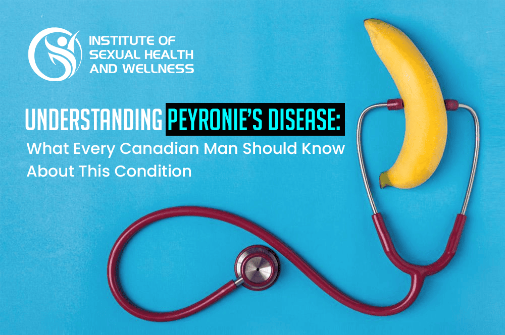 Peyronie’s disease
